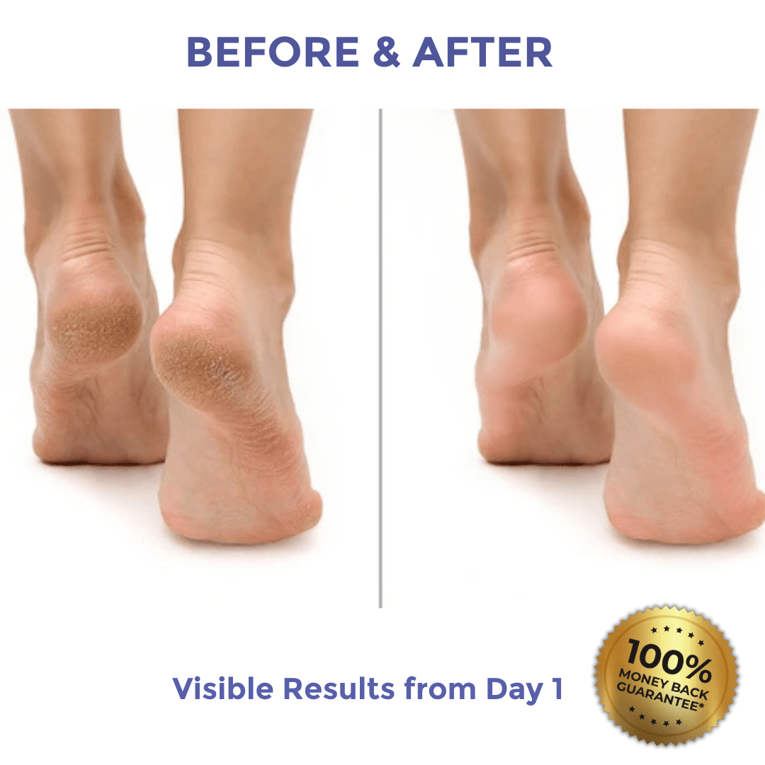 Diamond Luxe Heel Balm for Dry & Cracked Heels