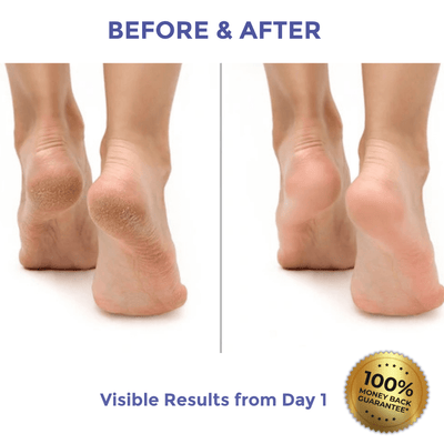 Diamond Luxe Heel Balm for Dry & Cracked Heels